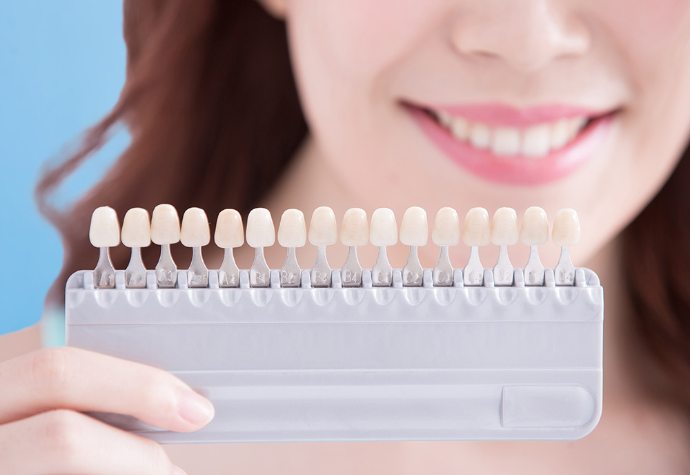 porcelain veneers in west edmonton