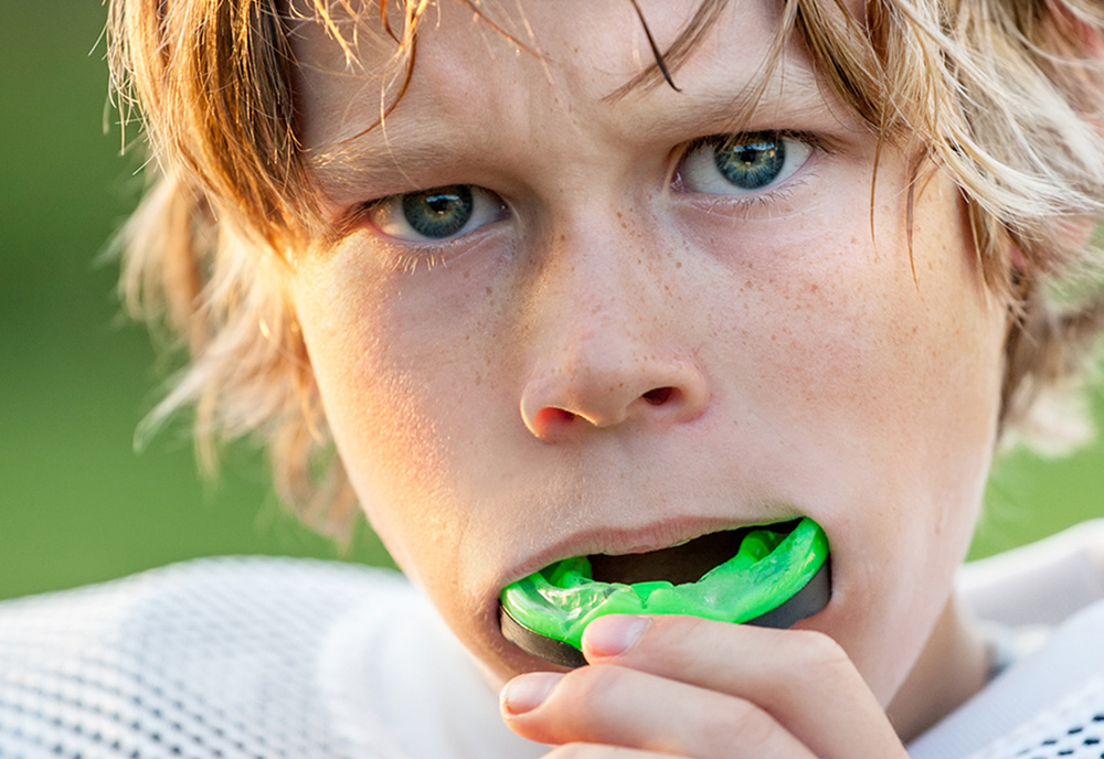 mouth guards in West Edmonton