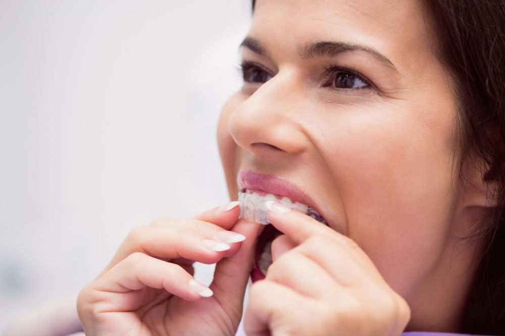 invisalign treatment how clear aligners straighten your teeth