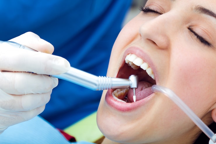 what is tooth contouring and who is it for